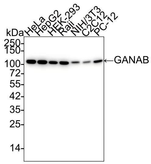 alpha Glucosidase 2 Antibody (PSH01-52) Western Blot: alpha Glucosidase 2 Antibody (PSH01-52) [NBP3-32366]