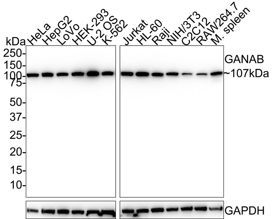 alpha Glucosidase 2 Antibody (PSH01-52) Western Blot: alpha Glucosidase 2 Antibody (PSH01-52) [NBP3-32366]