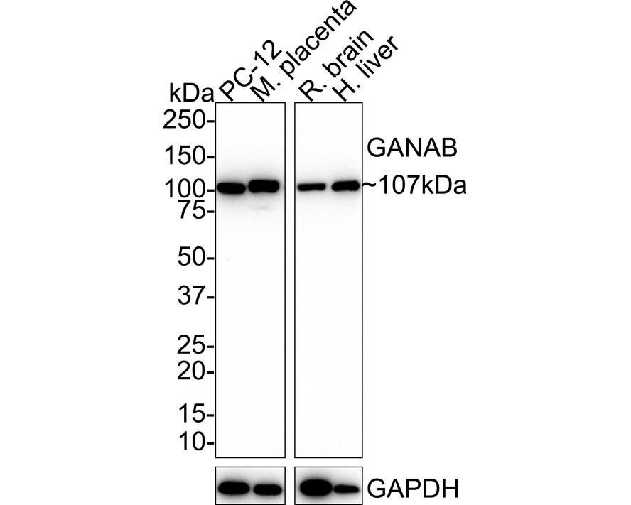 alpha Glucosidase 2 Antibody (PSH01-52) Western Blot: alpha Glucosidase 2 Antibody (PSH01-52) [NBP3-32366]