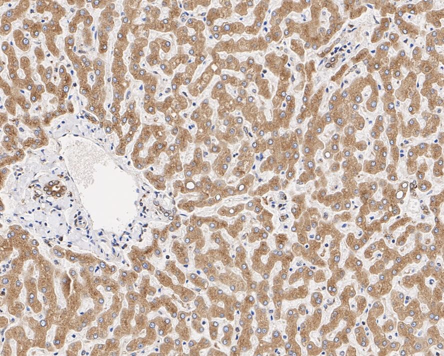 alpha Glucosidase 2 Antibody (PSH01-52)