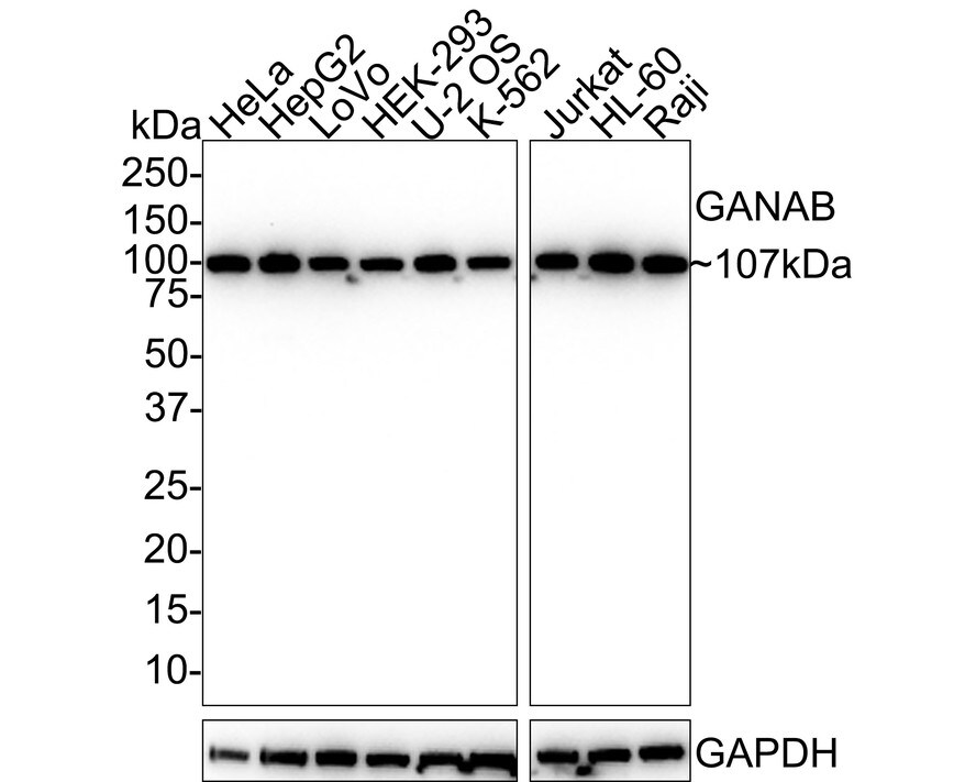 alpha Glucosidase 2 Antibody (PSH01-53) Western Blot: alpha Glucosidase 2 Antibody (PSH01-53) [NBP3-32367]