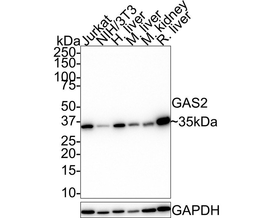 GAS2 Antibody (JE48-38) Western Blot: GAS2 Antibody (JE48-38) [NBP3-32368]