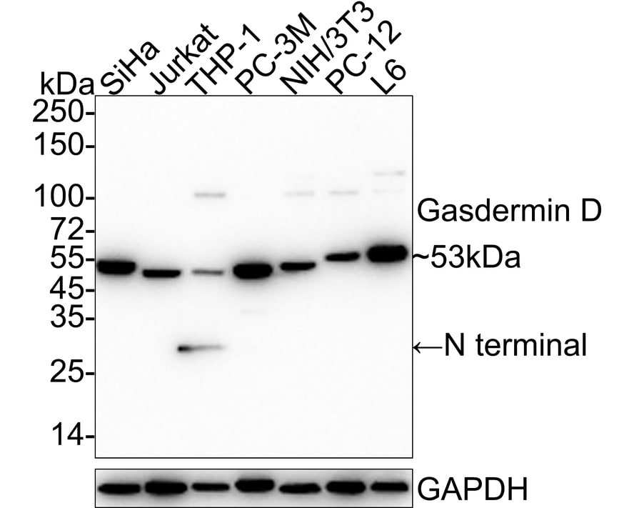 Gasdermin D Antibody (PD00-18) - N-terminal Western Blot: Gasdermin D Antibody (PD00-18) - N-terminal [NBP3-32369]