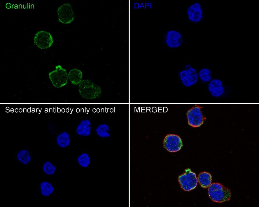 Granulin Antibody (JE37-73)