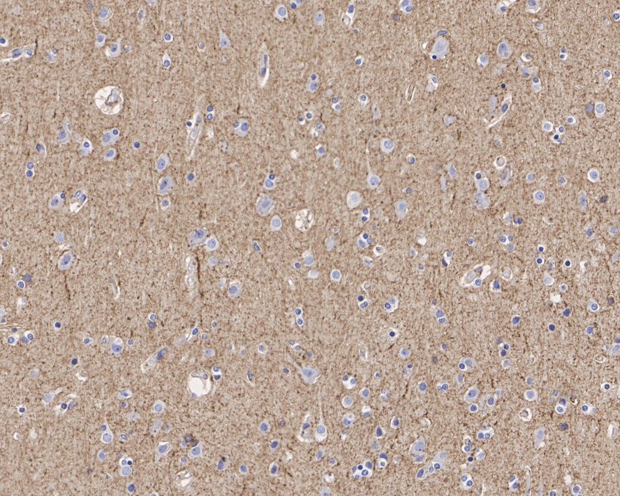 GAT-1/SLC6A1 Antibody (JE34-61)