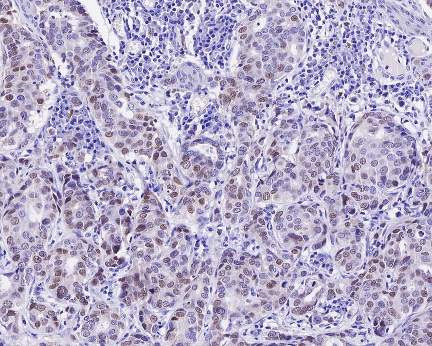 GATA-3 Antibody (PD00-41)