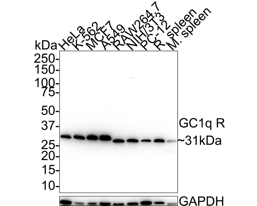 HABP1/C1QBP/GC1q R Antibody (A8F4-R) Western Blot: HABP1/C1QBP/GC1q R Antibody (A8F4-R) [NBP3-32376]