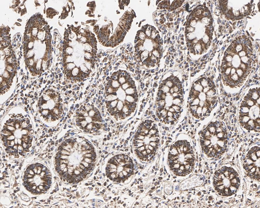 HABP1/C1QBP/GC1q R Antibody (A8F5-R)