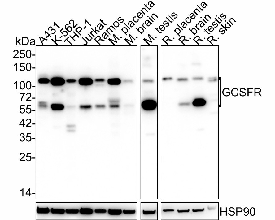 G-CSFR/CD114 Antibody (PSH03-44) Western Blot: G-CSFR/CD114 Antibody (PSH03-44) [NBP3-32378]