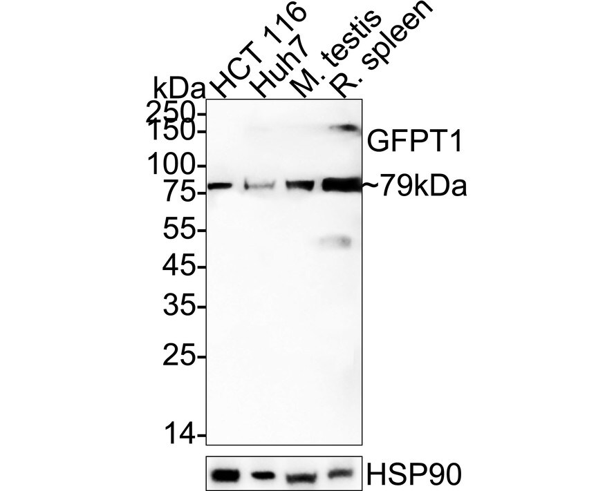 GFPT1 Antibody (JE43-68) Western Blot: GFPT1 Antibody (JE43-68) [NBP3-32379]