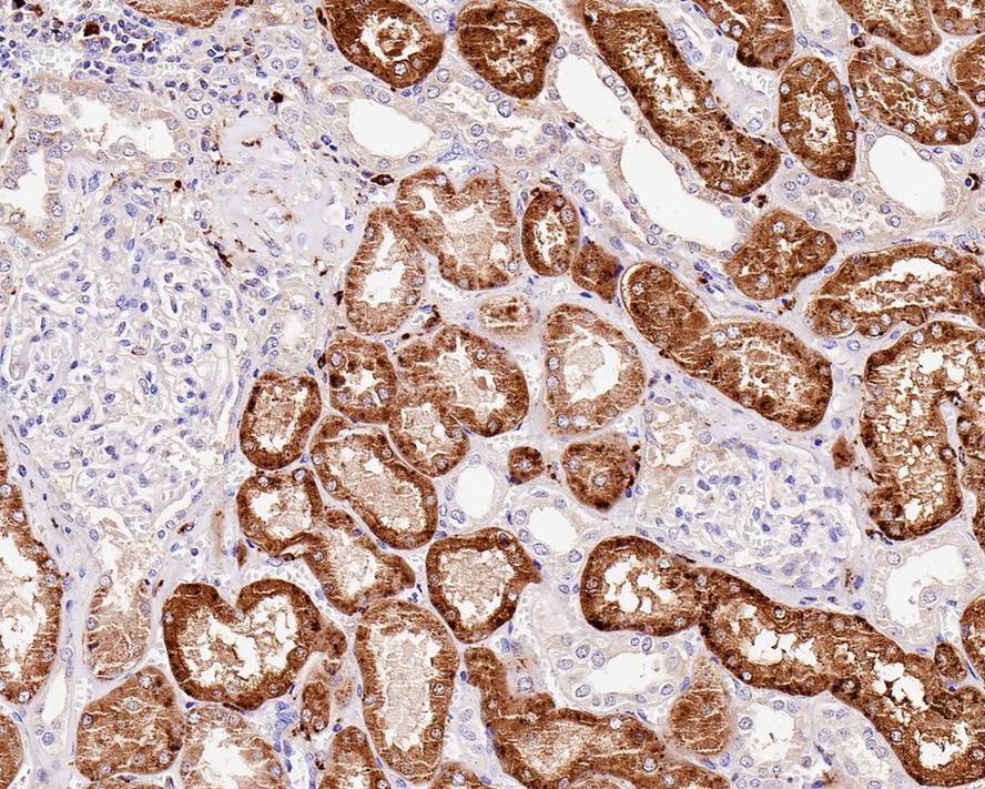 gamma-glutamyl hydrolase Antibody (JE61-78)