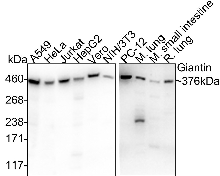 GOLGB1/Giantin Antibody (PSH03-86) Western Blot: GOLGB1/Giantin Antibody (PSH03-86) [NBP3-32381]