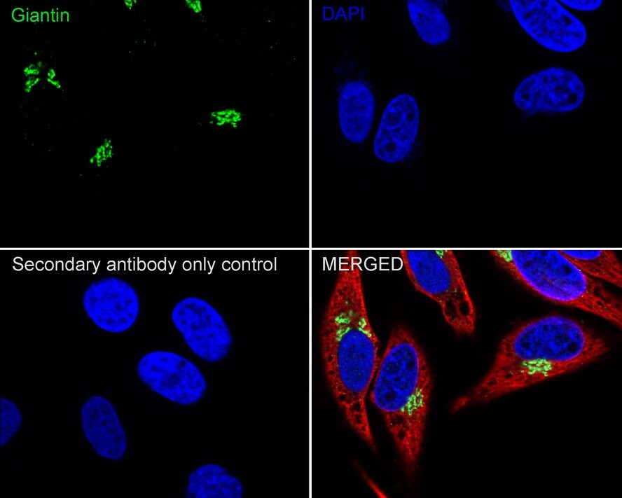 GOLGB1/Giantin Antibody (PSH03-86)
