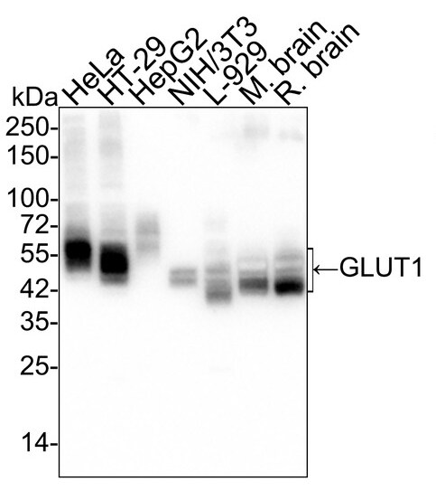 Glut1 Antibody (SA0377) Western Blot: Glut1 Antibody (SA0377) [NBP3-32385]