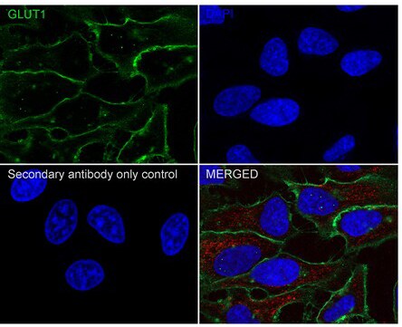 Glut1 Antibody (SA0377)