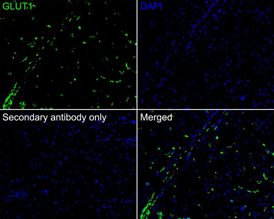 Glut1 Antibody (SA0377)