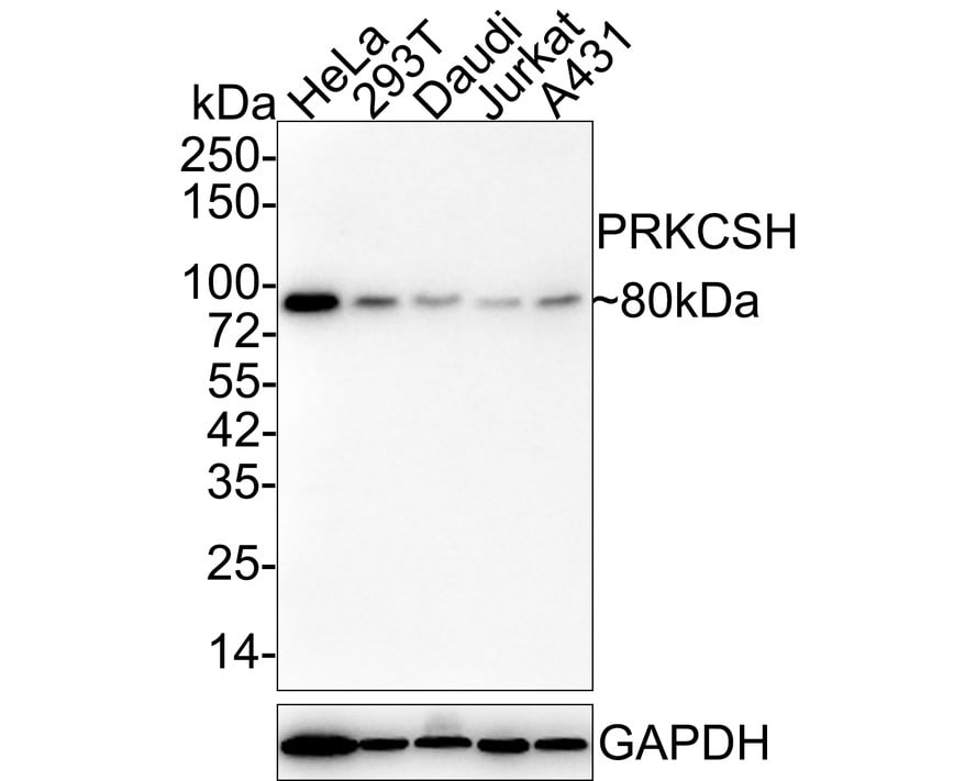 PRKCSH Antibody (A6H9-R) Western Blot: PRKCSH Antibody (A6H9-R) [NBP3-32386]