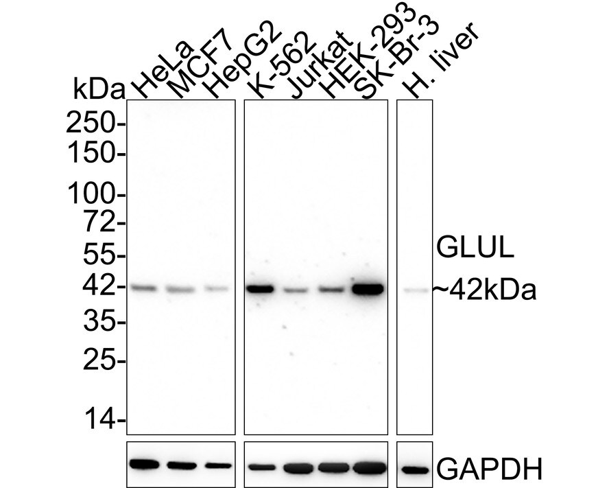 Glutamine Synthetase Antibody (A3G2-R)