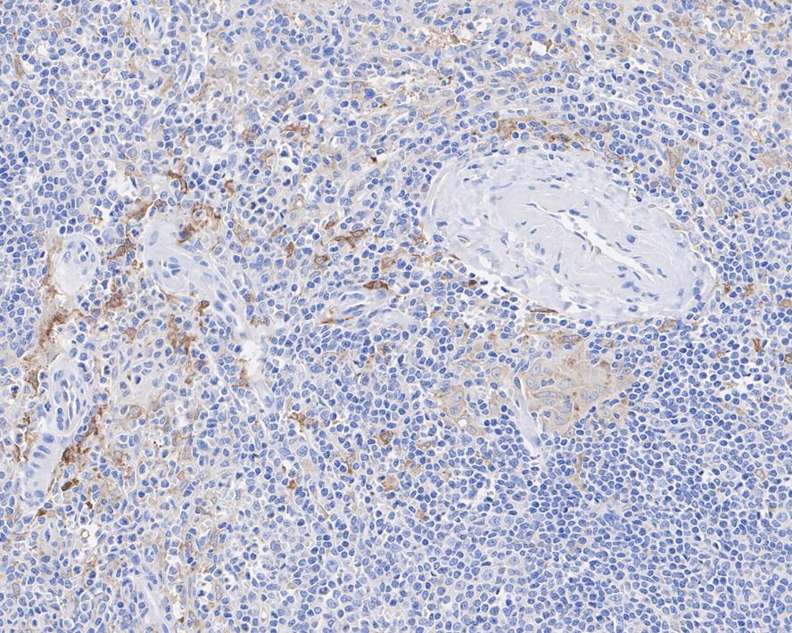Glutamine Synthetase Antibody (A3G2-R)