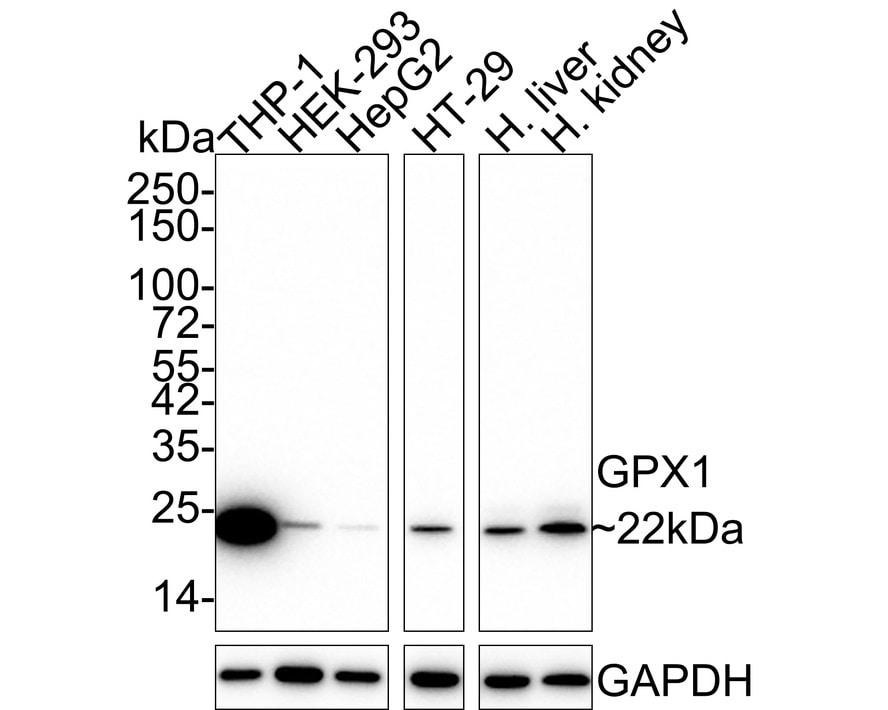 Glutathione Peroxidase 1/GPX1 Antibody (A6-C0-B9-R) Western Blot: Glutathione Peroxidase 1/GPX1 Antibody (A6-C0-B9-R) [NBP3-32388]