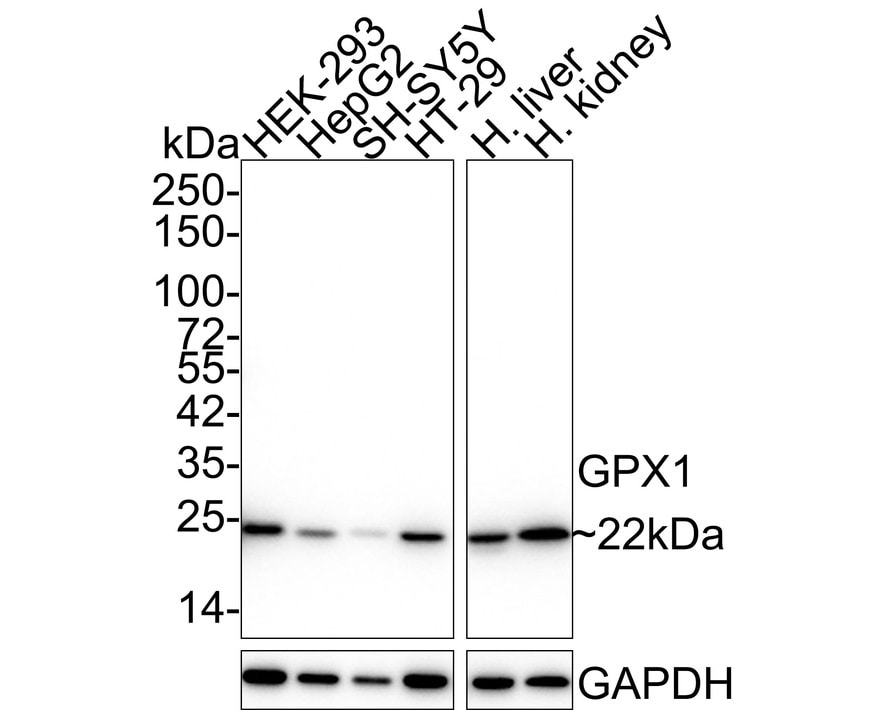 Glutathione Peroxidase 1/GPX1 Antibody (C5-A10-R) Western Blot: Glutathione Peroxidase 1/GPX1 Antibody (C5-A10-R) [NBP3-32389]