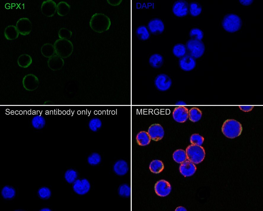 Glutathione Peroxidase 1/GPX1 Antibody (C5-A10-R)