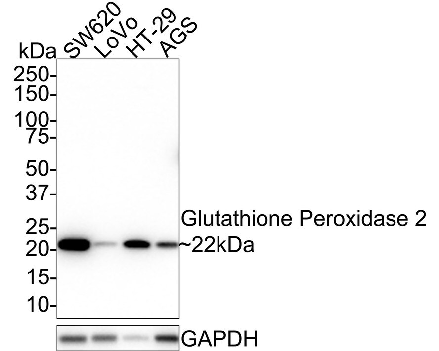 Glutathione Peroxidase 2/GPX2 Antibody (JE40-73) Western Blot: Glutathione Peroxidase 2/GPX2 Antibody (JE40-73) [NBP3-32390]