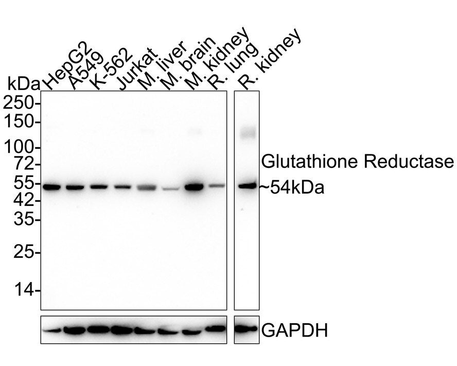 Glutathione Reductase Antibody (JE31-42) Western Blot: Glutathione Reductase Antibody (JE31-42) [NBP3-32391]