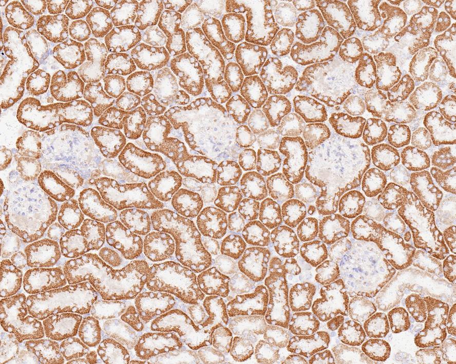 GM130/GOLGA2 Antibody (JE42-53)