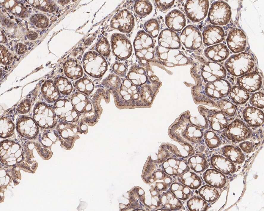 GNAQ Antibody (JE65-59)