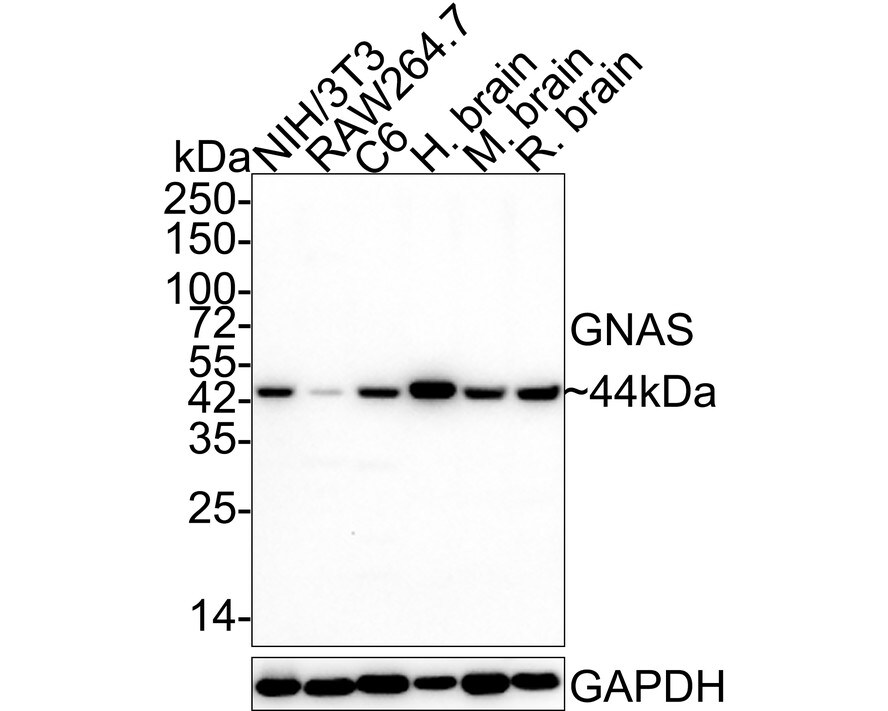 G protein alpha Antibody (A8F11-R) Western Blot: G protein alpha Antibody (A8F11-R) [NBP3-32396]