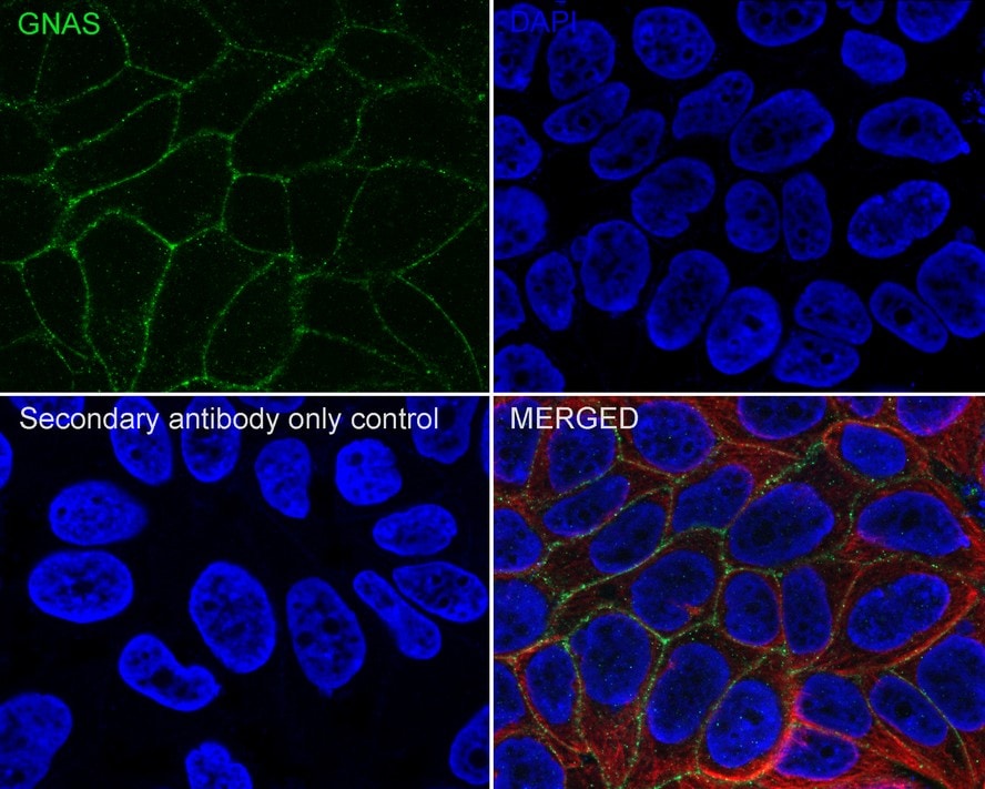 G protein alpha Antibody (A8F11-R)