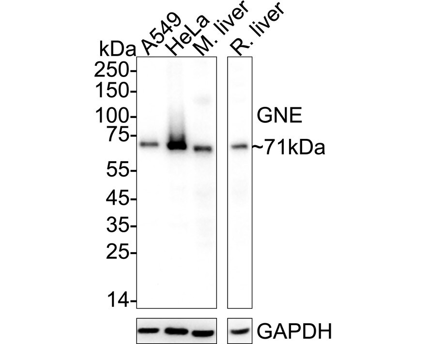N-Acetylmannosamine Kinase/GNE Antibody (JE64-81) Western Blot: N-Acetylmannosamine Kinase/GNE Antibody (JE64-81) [NBP3-32397]