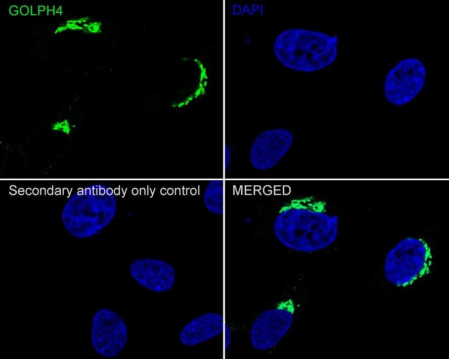 GOLPH4 Antibody (PSH02-98)