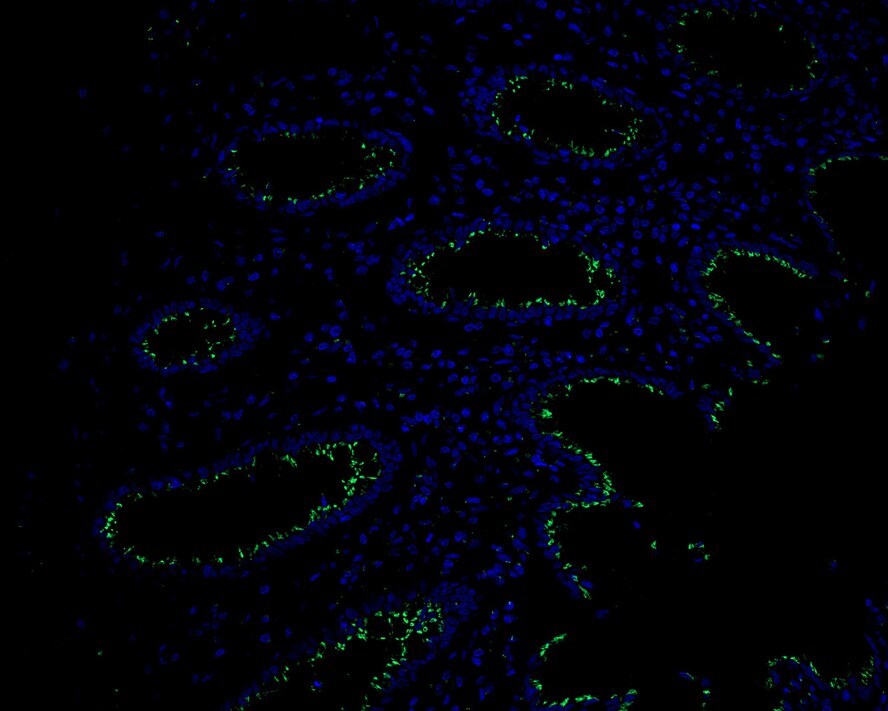 GOLPH4 Antibody (PSH02-98)