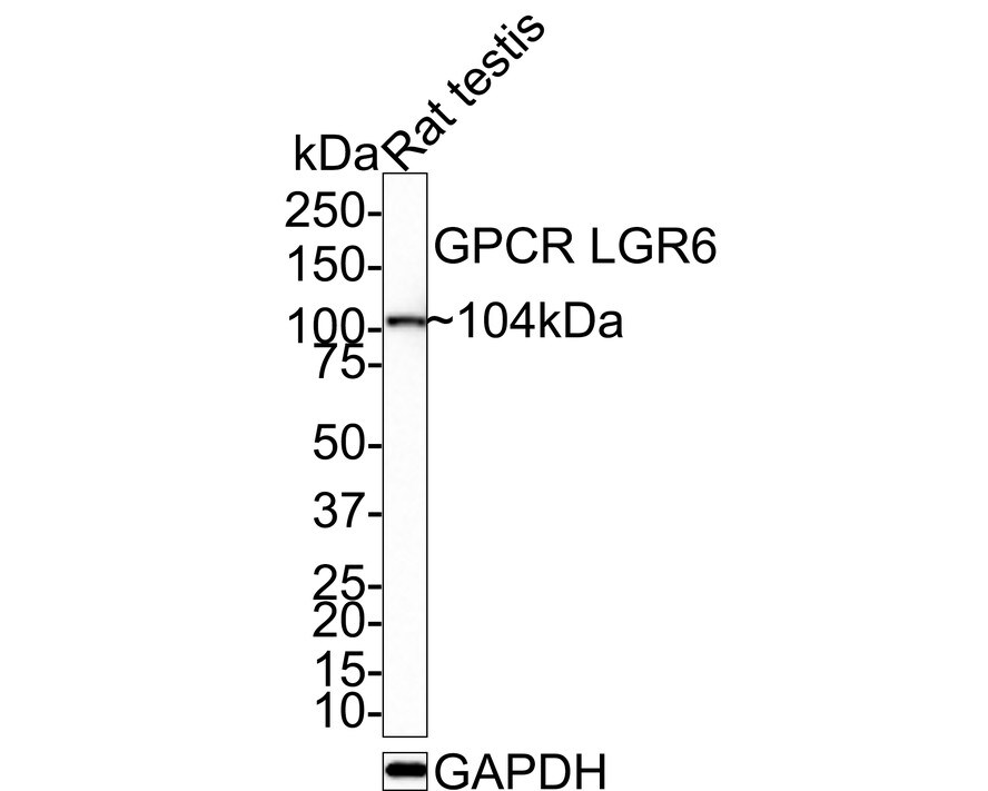 Lgr6 Antibody (JE39-78) Western Blot: Lgr6 Antibody (JE39-78) [NBP3-32400]