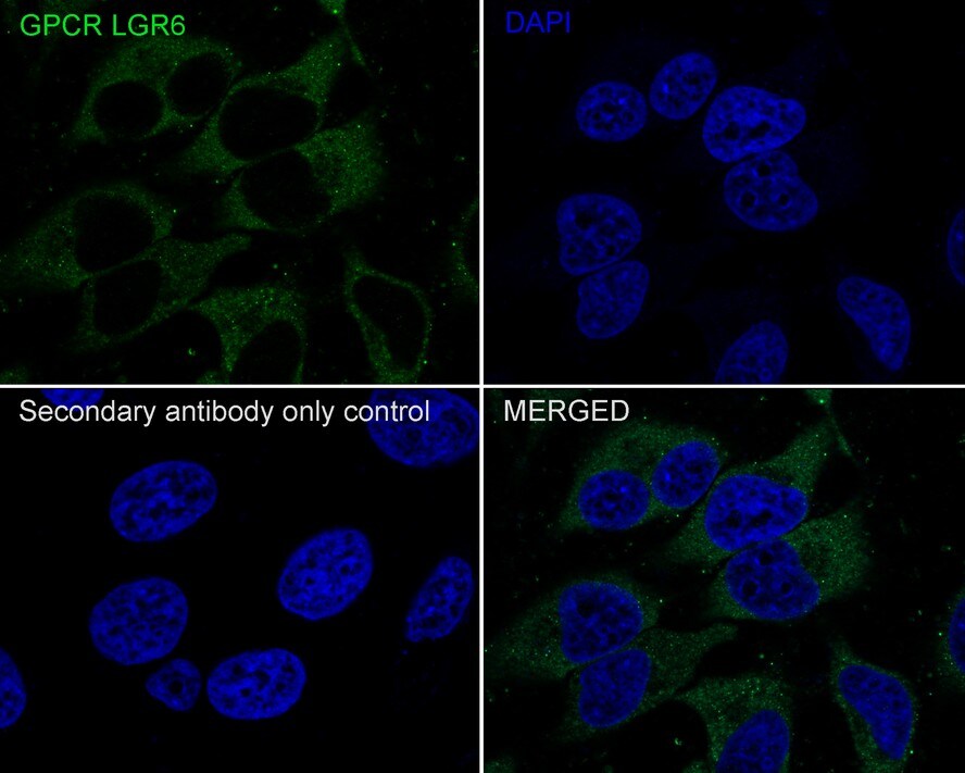 Lgr6 Antibody (JE39-78)