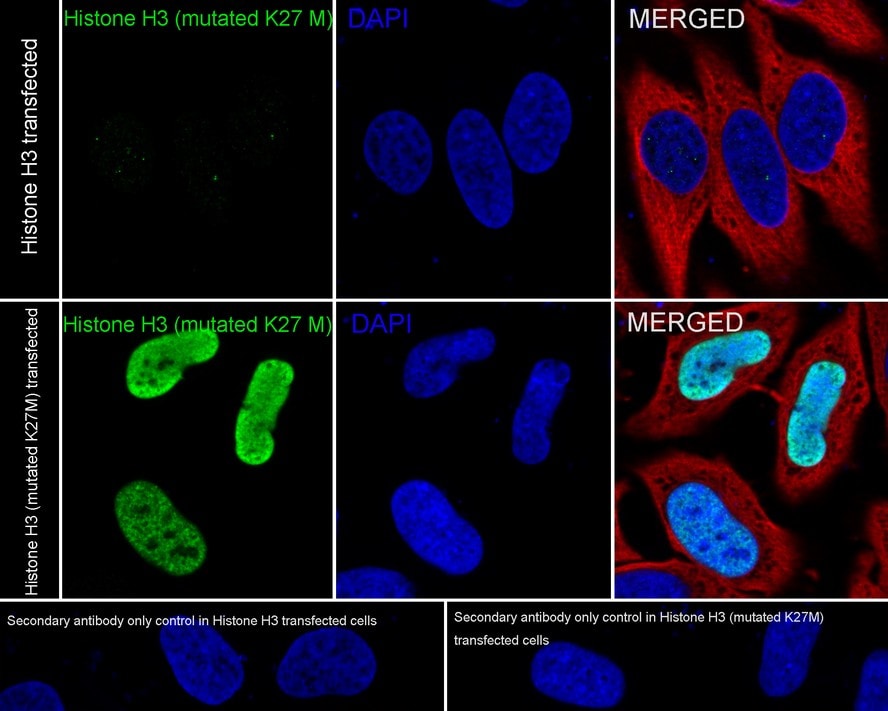 Histone H3 Antibody (JE46-51) - K27M mutant