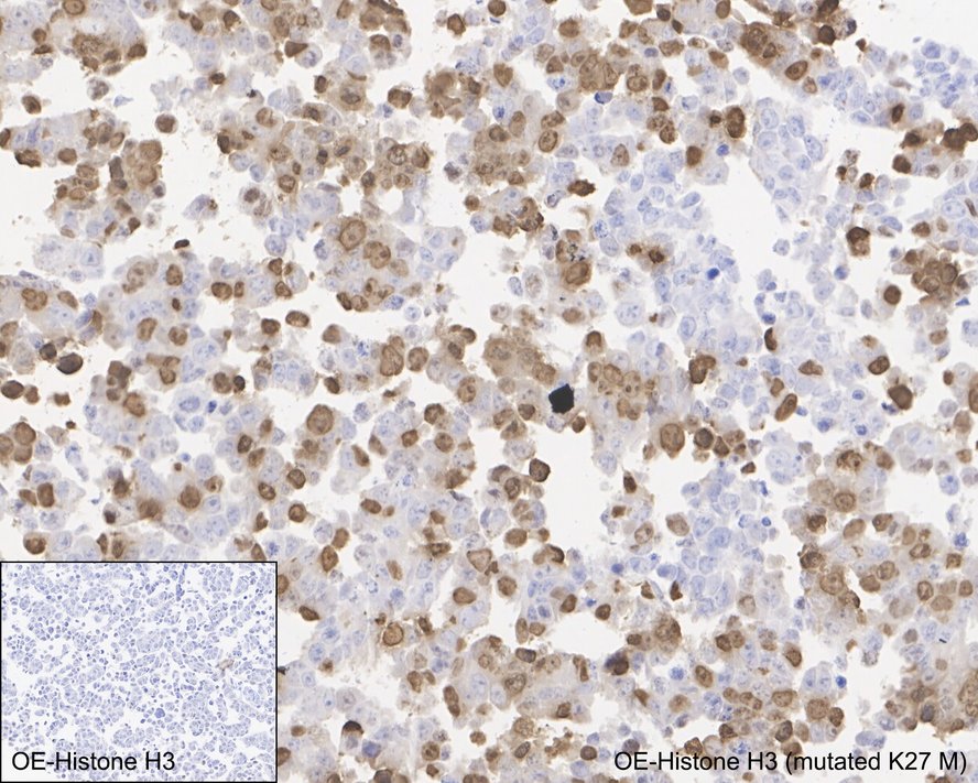 Histone H3 Antibody (JE46-51) - K27M mutant