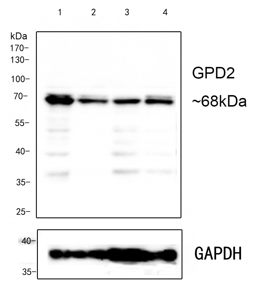 GPD2 Antibody (PSH0-31) Western Blot: GPD2 Antibody (PSH0-31) [NBP3-32402]