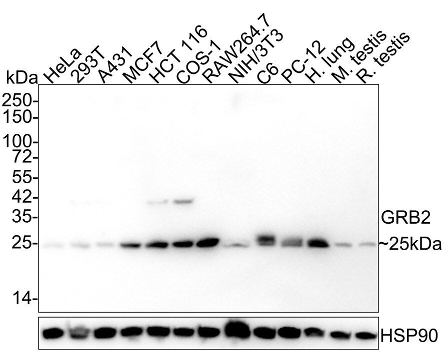 GRB2 Antibody (JE49-73) Western Blot: GRB2 Antibody (JE49-73) [NBP3-32403]