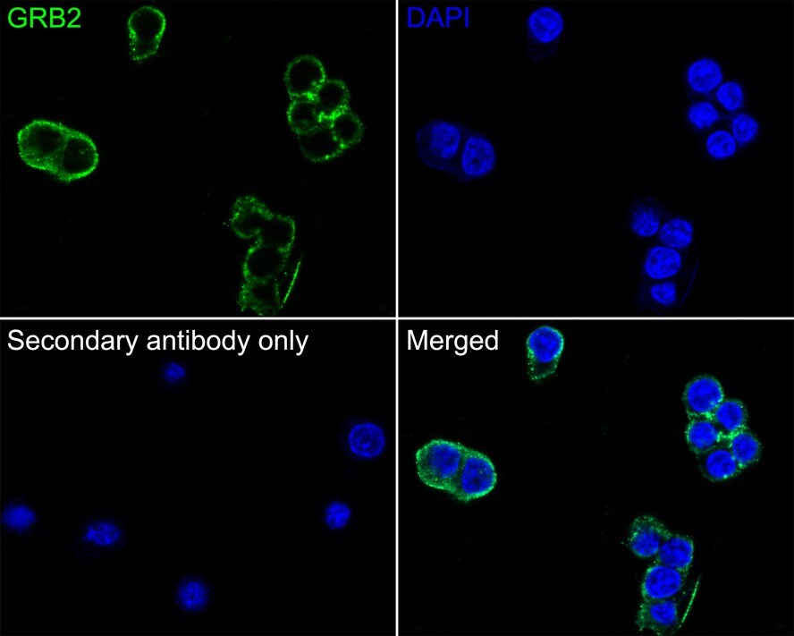 GRB2 Antibody (JE49-73)