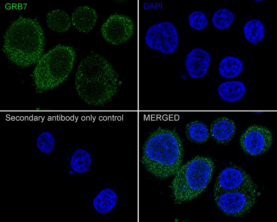 GRB7 Antibody (JE50-05)