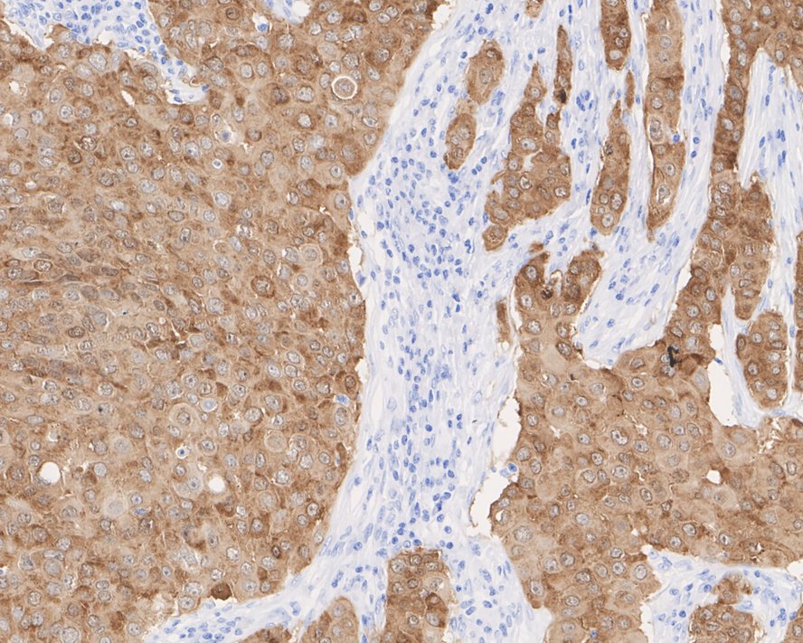 GRB7 Antibody (JE50-05)