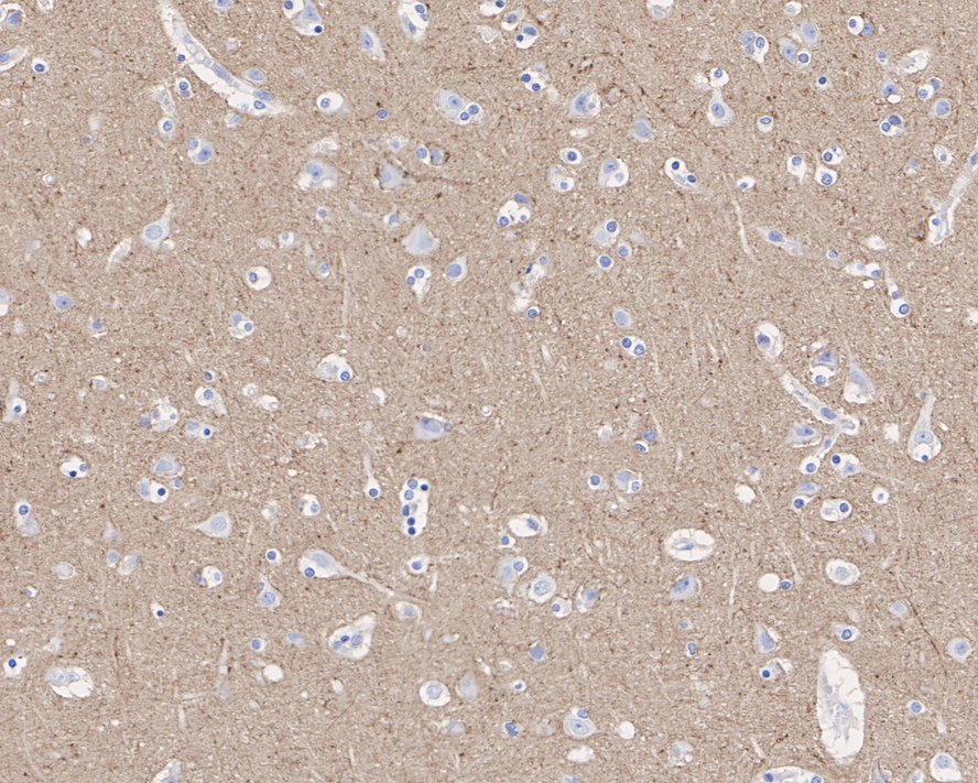 Glutamate Receptor 6 Antibody (JE39-33)