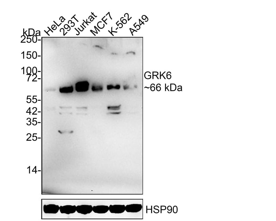 GRK6 Antibody (JE63-06) Western Blot: GRK6 Antibody (JE63-06) [NBP3-32406]