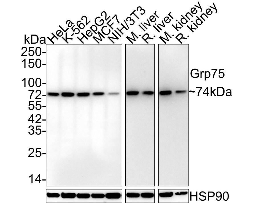 GRP75/HSPA9B/Mortalin Antibody (6-A9-R) Western Blot: GRP75/HSPA9B/Mortalin Antibody (6-A9-R) [NBP3-32407]