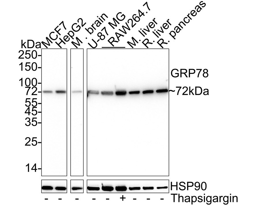 GRP78/HSPA5 Antibody (C9-9-R) Western Blot: GRP78/HSPA5 Antibody (C9-9-R) [NBP3-32408]
