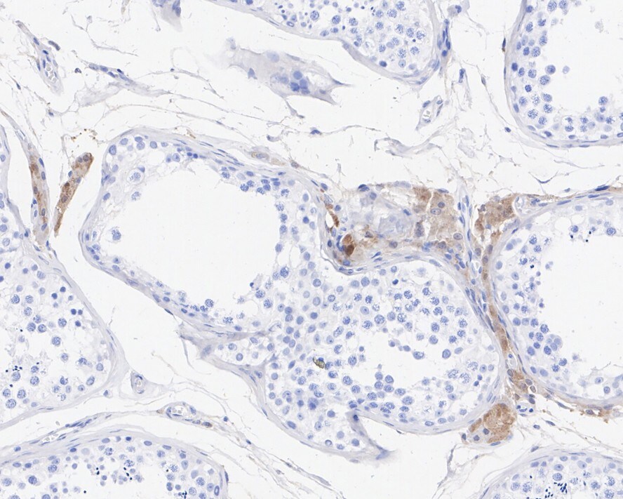 Glutathione S-Transferase pi 1/GSTP1 Antibody (11D5-R)