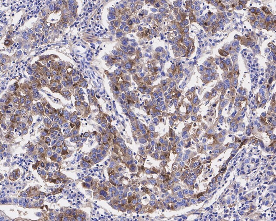 HRAS Antibody (JE42-15)